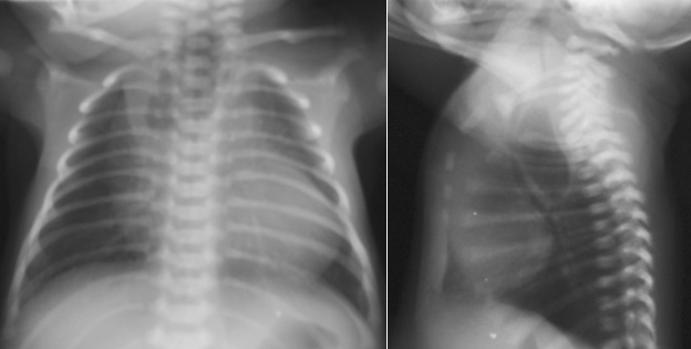ginseng sex paste vertebral anal esophageal